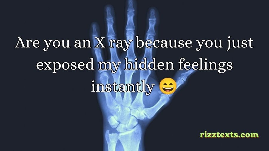 X Ray Rizz Lines