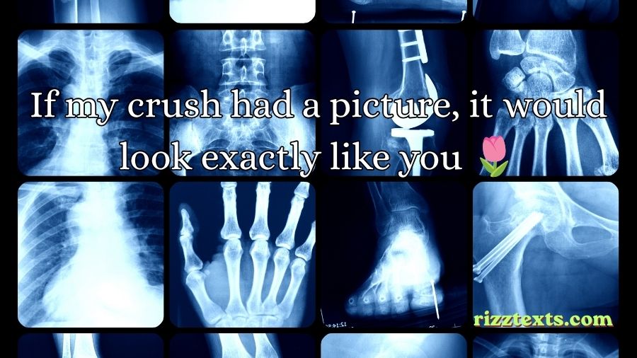 X Ray Rizz Lines