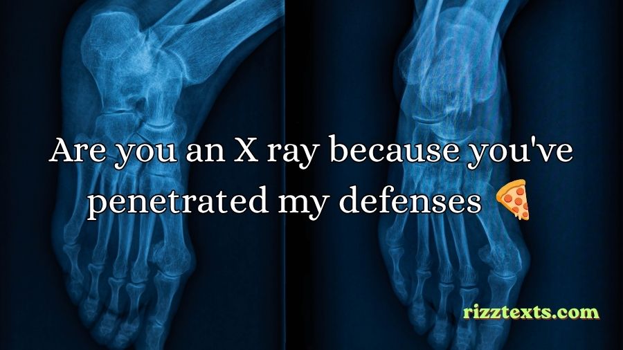 X Ray Rizz Lines